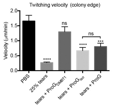 DMBT1-depleted human tear fluid does not inhibit twitching motility of PAO1.jpg